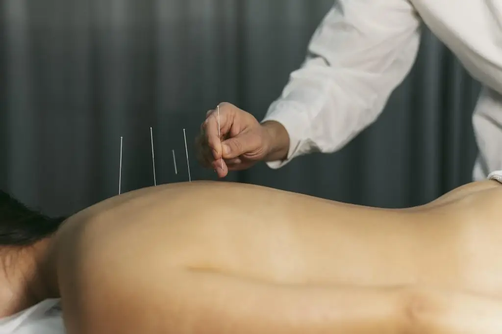 Acupuncturist in Enschede
